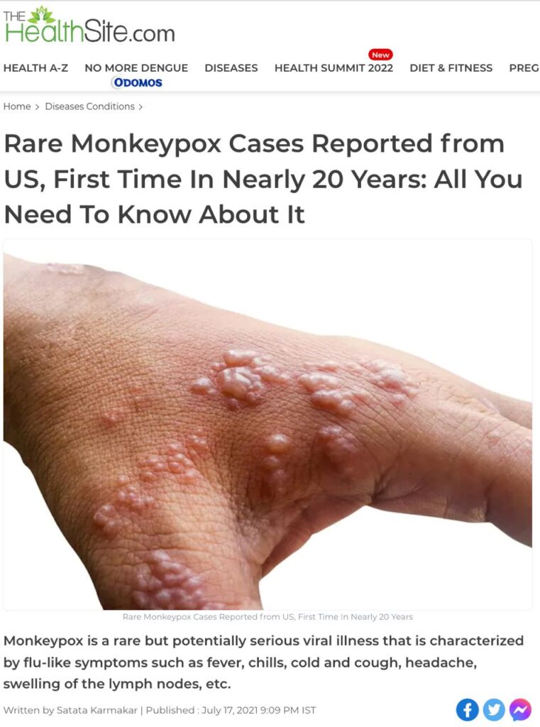 Un lien entre vaccin Coco et cette variole du singe ?